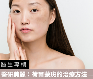 【醫生專欄】醫研美麗：荷爾蒙斑的治療方法