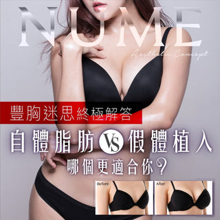 豐胸迷思終極解答:自體脂肪 VS 假體植入,哪個更適合你?