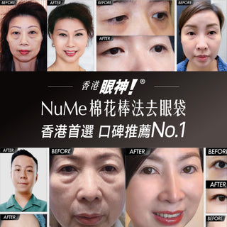【時光無法逆轉，但眼袋可以！ DEYA 教你30分鐘解決眼袋問題】