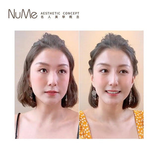 【顏值要升級・鼻型是關鍵・15分鐘提升整體顏值】