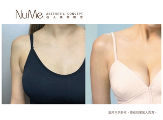 Belkyra 溶脂針