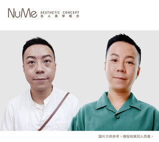 【醫生警告：90%眼袋失敗案例 都因這3大迷思！】