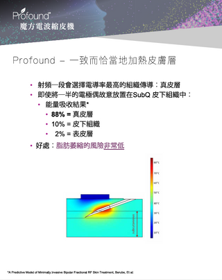 Profound 魔方電波縮皮機