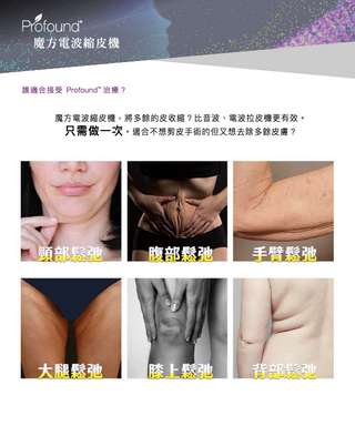 Profound 魔方電波縮皮機
