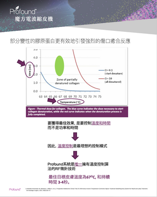 Profound 魔方電波縮皮機