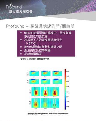 Profound 魔方電波縮皮機