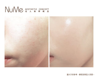Belotero® Revive 新一代亮白保濕針
