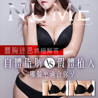 【自體脂肪豐胸 vs 假體植入，哪個更適合你？ 】