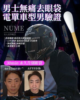 男人的眼袋，影響的不只是外表。30+成功男士必看。